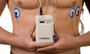 Аритмия у детей