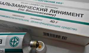 6 эффективных мазей от синяков и гематом после уколов
