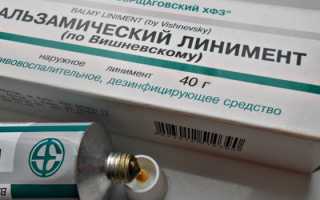 6 эффективных мазей от синяков и гематом после уколов