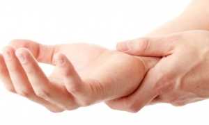 Отек рук — причины и сопутствующие симптомы, методы лечения