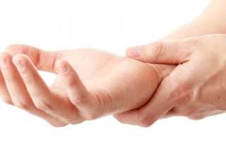 Отек рук — причины и сопутствующие симптомы, методы лечения