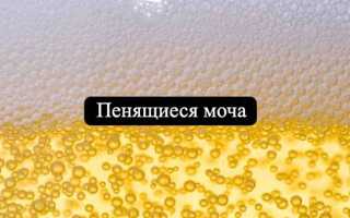 Пенится моча, причины почему возникает пена при мочеиспускании у мужчин и женщин