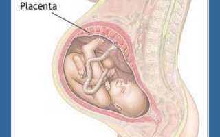 Врастание плаценты в рубец на теле матки: опасная патология