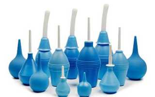 Зачем нужно спринцевание при эндометриозе: топ-5 лекарственных отваров