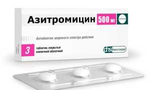 Антибиотики при боли в горле: лучшие препараты для лечения