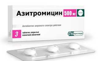 Антибиотики при боли в горле: лучшие препараты для лечения