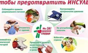 Предвестники инсульта у мужчин и женщин — первые признаки и причины, основные предпосылки и симптомы