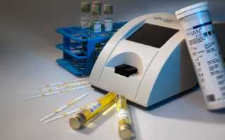 Исследование мочи на анализаторе