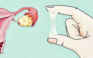 Как выглядит пробка при беременности