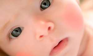 Красные щеки у ребенка: причины покраснений