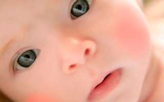 Красные щеки у ребенка: причины покраснений