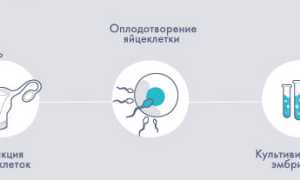 Какова статистика протоколов ЭКО