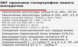 ЭКГ признаки гипертрофии левого желудочка сердца