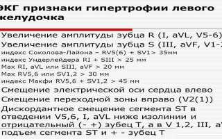 ЭКГ признаки гипертрофии левого желудочка сердца