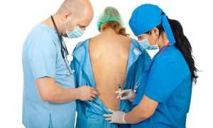 Обезболивающие уколы при болях в спине — эффективные медикаменты с инструкцией и дозировкой