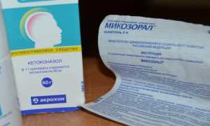 Эффективные методы и препараты для лечения грибка на голове