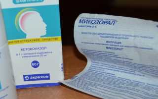 Эффективные методы и препараты для лечения грибка на голове