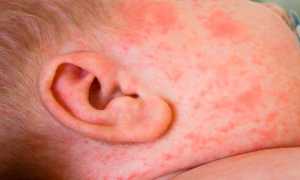 Грудной сбор при бронхите у детей — инструкция по применению, показания, состав и цена