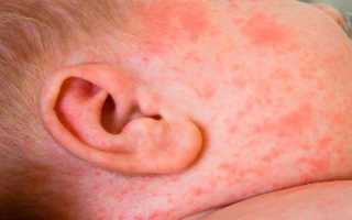 Грудной сбор при бронхите у детей — инструкция по применению, показания, состав и цена