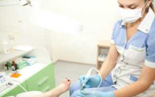 Использование аппаратного педикюра при лечении ногтей от грибка