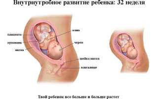 Чего ожидать при родах на 32 неделе беременности?