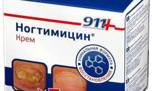 Особенности лечения грибковой инфекции Ногтимицином