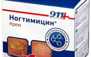 Особенности лечения грибковой инфекции Ногтимицином