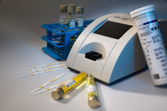 Исследование мочи на анализаторе