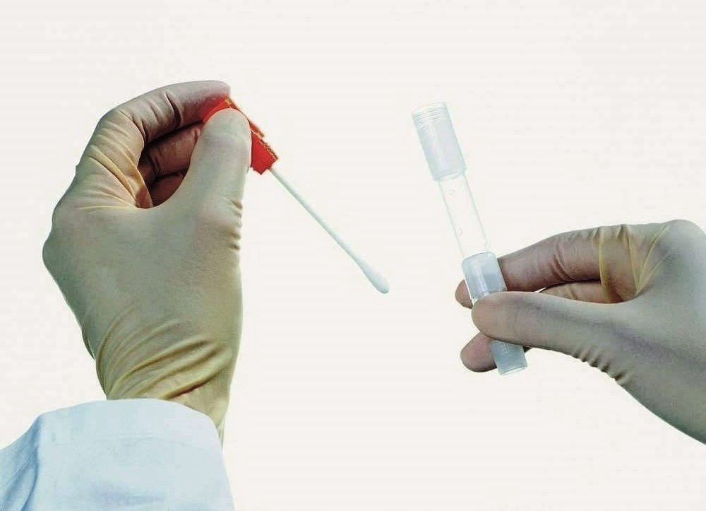 Исследование отделяемого мочеполовых органов женщин