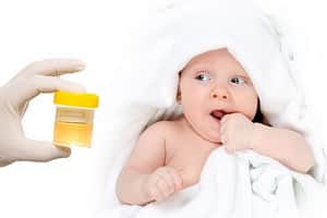 Как пользоваться мочеприемником для мальчиков новорожденных