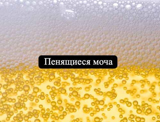 Пенится моча, причины почему возникает пена при мочеиспускании у мужчин и женщин