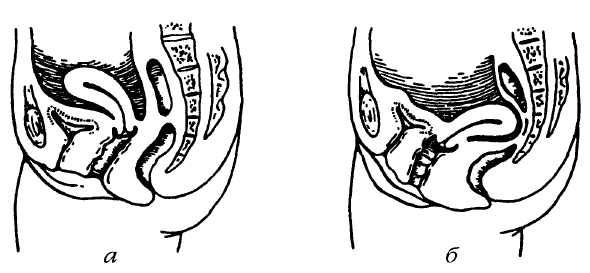 Отличие от нормы