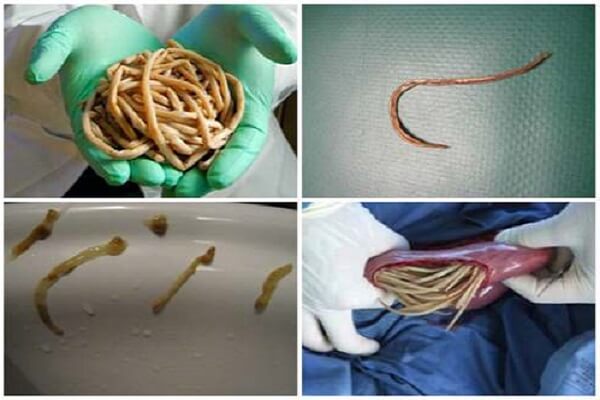 Паразиты в человеческом организме Паразиты - фото