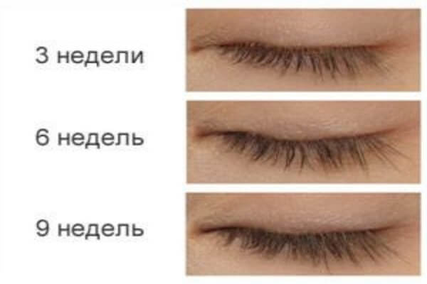Применение касторовое масло для ресниц Применение касторки для ресниц: фото до и после