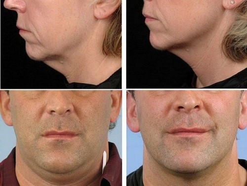 121217_9.jpg 121217_9.jpg