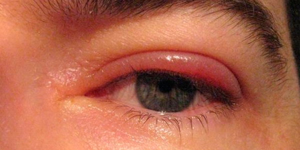 Otek-veka1.jpg Otek-veka1.jpg