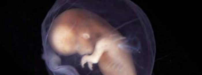 Диагностика замершей беременности - Диагностика замершей беременности