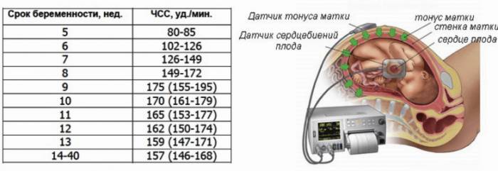 Гипертонус матки - угроза прерывания беременности - Гипертонус матки - угроза прерывания беременности
