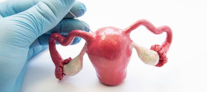 Острый эндометрит Острый эндометрит -