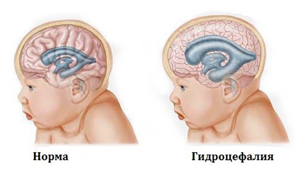 161017_16.jpg 161017_16.jpg