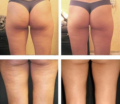 121217_42.jpg 121217_42.jpg