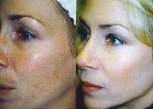 121217_8.jpg 121217_8.jpg