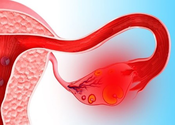 161017_31.jpg 161017_31.jpg