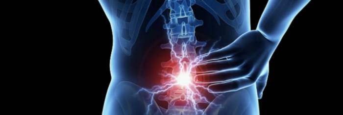 Причины дегенеративных изменений позвоночника - Причины дегенеративных изменений позвоночника