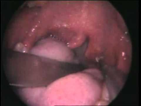 hqdefault.jpg hqdefault.jpg