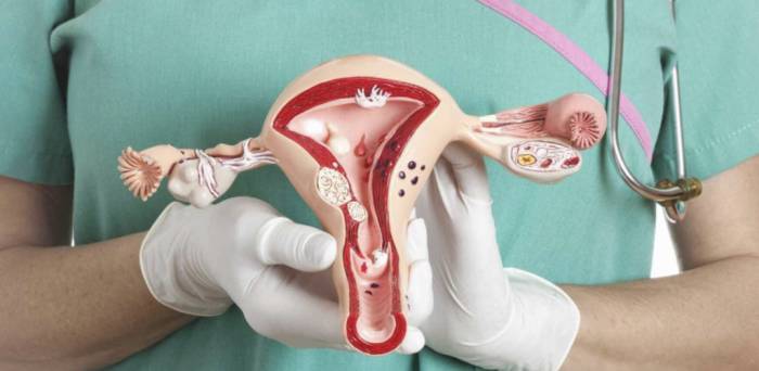 Как проходит пайпель-биопсия эндометрия? - Как проходит пайпель-биопсия эндометрия?