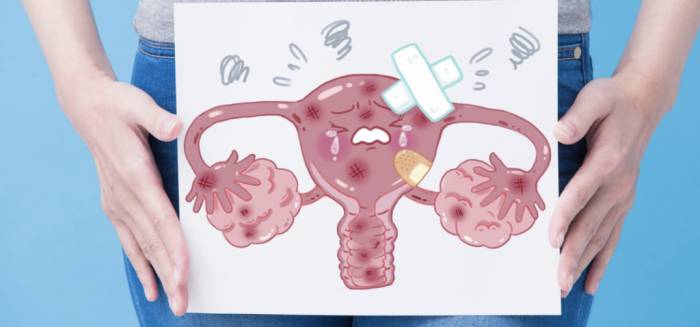 Хронический эндометрит у женщин Хронический эндометрит у женщин -