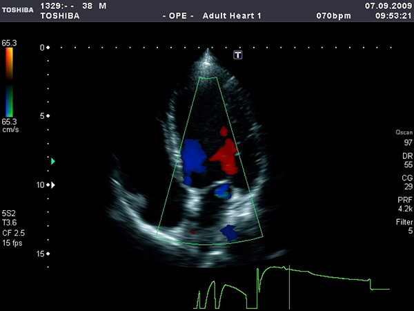 011217_36.jpg 011217_36.jpg