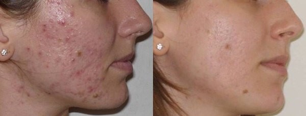 121217_5.jpg 121217_5.jpg