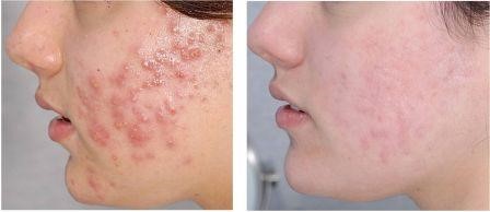 121217_6.jpg 121217_6.jpg